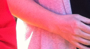 farbige-Reflexion-CarmenArmDetail